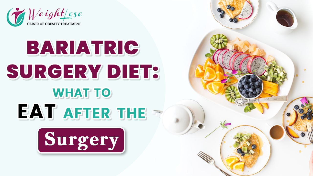 Bariatric Surgery Diet: What to eat after the surgery